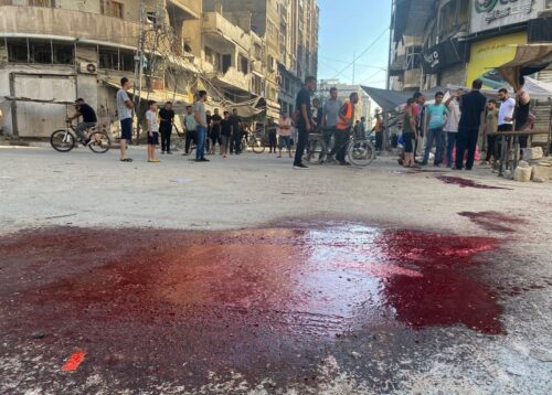 Gaza is Changing All of Us